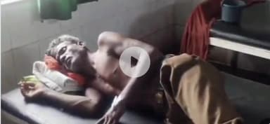 स्लीमनाबाद: हर्रई बोरी में बकरी चराने गए चरवाहे पर बाघ का हमला, 20 मिनट तक जूझता रहा, अस्पताल में भर्ती