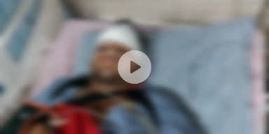 बागपत: सांकरौद का एक युवक बड़ौत शहर स्थित दिल्ली-सहारनपुर हाइवे पर डाक कावंड के कैंटर की छत से गिरकर चोटिल, कराया गया भर्ती