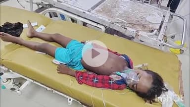 चरपोखरी: मनैनी टोला पर बिच्छू के डंक मारने से एक बच्चे की हुई मौत, परिजनों में मचा चीख-पुकार