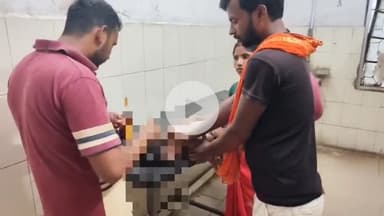 पंडारक: एनटीपीसी थाना क्षेत्र के दयालचक में 4 वर्षीय बच्चा छत से गिरकर हुआ गंभीर रूप से घायल