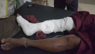 टीकमगढ़: हनोता गांव में एक शख्स ने महिला के साथ की बेरहमी से मारपीट, ज़िला अस्पताल में भर्ती