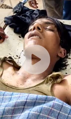 इचाक: बोंगा में वज्रपात से एक युवक की मौत, एक महिला घायल