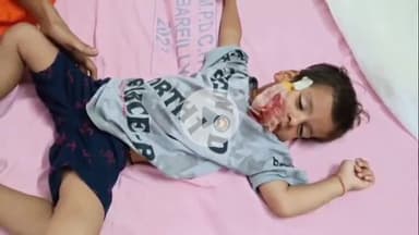 बरेली: थाना भोजीपुरा क्षेत्र के सागलपुर में आवारा कुत्तों ने किया जानलेवा हमला, मासूम घायल