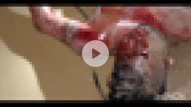 नबीनगर: उतर कोयल नहर से पुलिस ने बरामद किया अज्ञात व्यक्ति का शव, जांच में जुटी