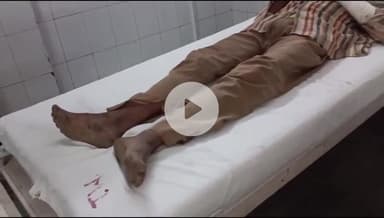 बांसवाड़ा: महुड़ा गांव में चचेरे भाई को समूह लोन की गारंटी देने पर चचेरे भाई ने भाई के साथ की मारपीट, एमजीएच में उपचार जारी