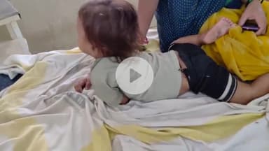 बेतिया: मोहझी बनकटवा गांव: 1 साल के बच्चे ने कोबरा को दांत काटा, खुद बेहोश, अस्पताल में भर्ती