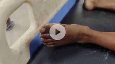 बेतिया: मंझरिया गांव में सर्पदंश से एक किसान की मौत, इलाज के दौरान तोड़ा दम