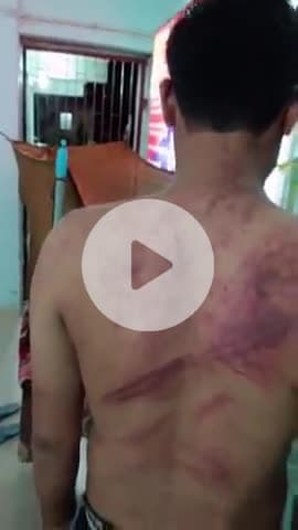 बेतिया: मेडिकल छात्रों की गुंडागर्दी: कैंसर मरीज से मिलने जा रहे युवक पर जानलेवा हमला