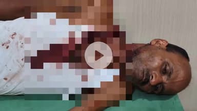 हरदोई: के म्योनी गांव में दबंगों के जानलेवा हमले में मण्डल उपाध्यक्ष बम्हनाखेड़ा अजीत सिंह व उनके साथी घायल, केस दर्ज