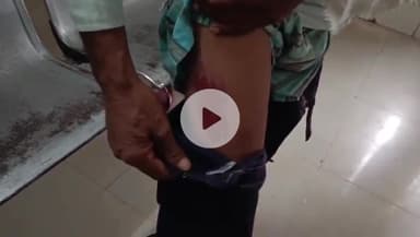 टीकमगढ़: दिनऊ गांव: खेत जोतने से मना करने पर पति-पत्नी से मारपीट, अस्पताल में भर्ती