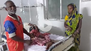 किस्को: किस्को-सेमरडीह मुख्य सड़क पर बाइक की टक्कर से साइकिल सवार गंभीर रूप से घायल, सदर अस्पताल में इलाज जारी