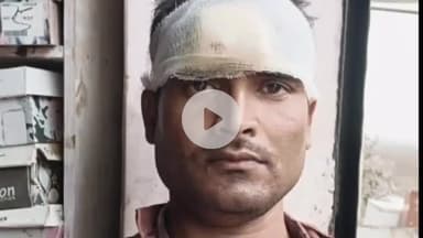 फरेंदा: मठिया ईदू टोला बिसउवां गांव में सरकारी मेड़ विवाद, बाप-बेटे पर हुआ हमला, जांच में जुटी पुलिस