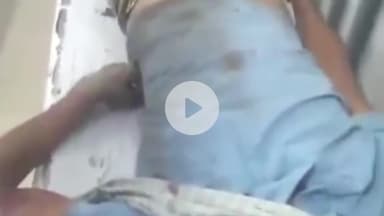 कहलगांव: कहलगांव NH-80 पर अनियंत्रित ट्रक ने एक व्यक्ति को रौंदा, अस्पताल में भर्ती