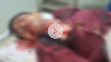 उदवंत नगर: कसाप और लाभुआनि के समीप ट्रक ने मोटरसाइकिल सवार युवक को रौंदा, घटनास्थल पर हुई दर्दनाक मौत