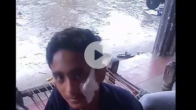 अमरोहा: डिडौली में अपनी माता को स्कूल से लेने जा रहे छात्र पर चाकू से हुआ हमला, घायल