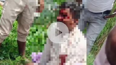 कसिया: शिवराय-तमकुहीरोड पर दमकला पीपा पुल के पास पलटी गाड़ी, रामपुर बरहन के ग्राम प्रधान अशर्फी यादव गंभीर रूप से घायल