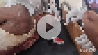 चकाई: गुड़ियाडीह गांव में कुदाल से काटकर एक व्यक्ति को किया घायल, मरणासन अवस्था में किया गया रेफर