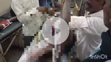 बहराइच: काशीपुरवा में करंट लगने से एक युवक झुलसा, अस्पताल में इलाज जारी