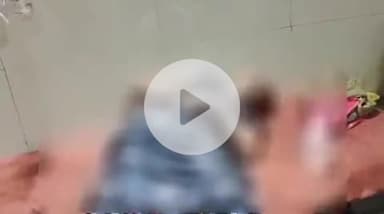 फिरोज़ाबाद: भगवान नगर में खाना बनाते समय कपड़ों में आग लगने से महिला गंभीर रूप से झुलसी, जिला अस्पताल में भर्ती