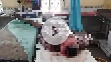 गोपालगंज: कोटवा गांव में सड़क दुर्घटना, बाइक सवार युवक जख्मी, अस्पताल से गोरखपुर रेफर