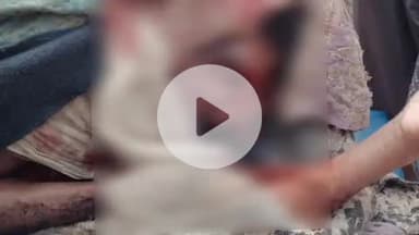 ग्राम रमकोला में भालू के हमले से गंभीर रूप से घायल हुआ ग्रामीण, पुटु खुखड़ी लेने जंगल गया था तभी हुआ हमला