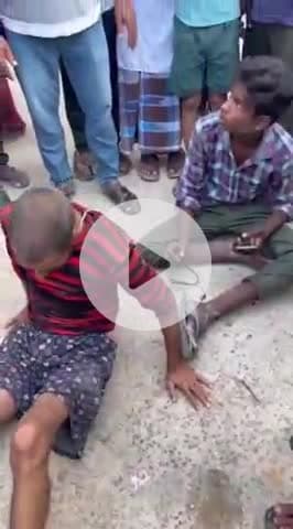 लंभुआ: तातोमुरैनी में खड़ी बाइक से टकराए नशे में धुत बाइक सवार 2 लोग, गंभीर रूप से हुए घायल