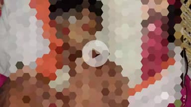 त्योंथर: चाकघाट में जन्मे अजीब बच्चे की मौत, रीवा में चल रहा था इलाज