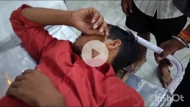 बरेली: रजऊ में दो मोटरसाइकिल आपस में टकराईं, बाइक सवार युवक गंभीर रूप से घायल हुआ