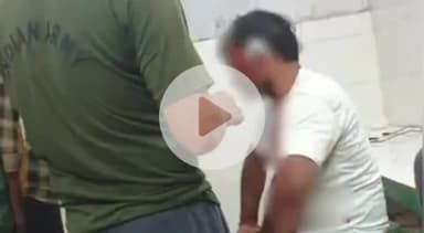 कादीपुर: अलीपुर बाजार मोड़ पर बाइक सवार कर्मचारी वनरोज से टकराया, गंभीर रूप से हुआ घायल