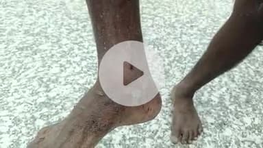 आरा: सक्कड़ी गांव स्थित धान के खेत में घूमते समय किसान को सांप ने काटा, गंभीर स्थिति में आरा सदर अस्पताल में कराया गया भर्ती