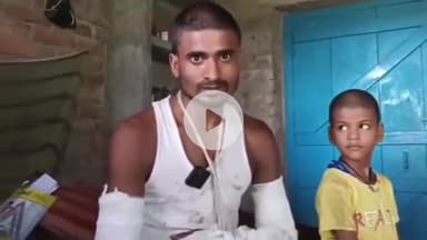 कहलगांव: कटोरिया: मामूली विवाद में बमबम शाह की शराब के नशे में पिटाई, दोनों हाथ तोड़े, पुलिस से न्याय की गुहार