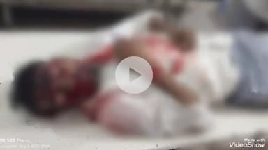 गरखा: फुरसतपुर चौक के पास सड़क दुर्घटना में एक युवक घायल, बाइक क्षतिग्रस्त