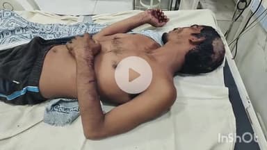 भीलवाड़ा: महुआखुर्द में जमीनी विवाद के चलते रिश्तेदारों ने जबरन घर में घुसकर भाई-बहन पर धारदार हथियारों से किया हमला