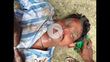 अमेठी: संदिग्ध परिस्थितियों में संग्रामपुर का युवक हुआ दुर्घटना का शिकार, पहचान बताने के बावजूद परिजनों से नहीं हो सका संपर्क