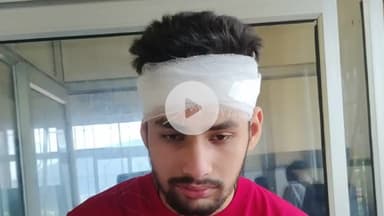 थल: बंदरों का थल कस्बे में आतंक, महिला सहित 2 लोगों को काटकर किया घायल