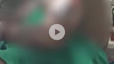 हुज़ूर: भोपाल: अन्ना नगर चौराहे पर दबंगों ने रंगदारी के लिए महिला पर उबलता तेल डाला, महिला अस्पताल में भर्ती