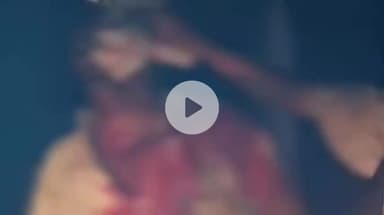 कप्तानगंज: कोकिल पट्टी में पीड़ित को न्याय की तलाश, हमलावर खुलेआम घूम रहे हैं – बिशनपुरा में कानून व्यवस्था सवालों के घेरे में