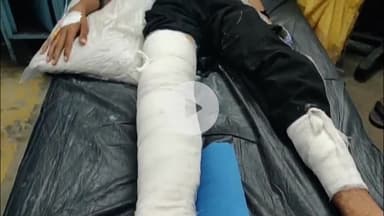 कोल: खेरेश्वर मंदिर के पास खड़े कांवड़ियों में घुसी तेज रफ्तार बाइक, तीन कांवड़िया गंभीर घायल, एक का टूटा पैर