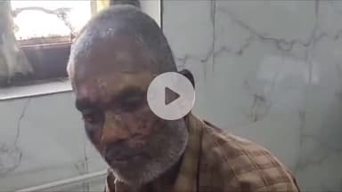 सिवनी: मुंगवानी गांव में करेंट लगने से व्यक्ति झुलसा, जिला अस्पताल में भर्ती