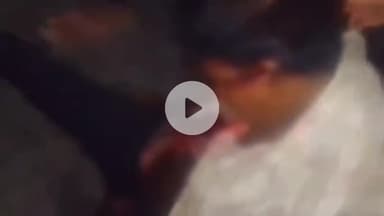 कांके: कांके थाना क्षेत्र में ऑटो चालक ने फल विक्रेता को मारी टक्कर, फल विक्रेता घायल