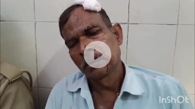 बरेली: प्रेम नगर थाना क्षेत्र समाधि गोटिया में दबंगों ने पुरानी रंजिश के चलते एक व्यक्ति के साथ जमकर लाठी-डंडों से मारपीट की