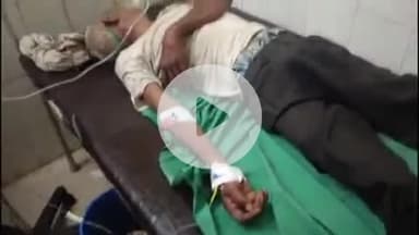 फतेहाबाद: फतेहाबाद तहसील मुख्यालय पर वृद्ध को सपेरे की पिटारी से सांप ने काटा, मचा हड़कंप, आगरा रेफर