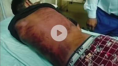 चूरू: सरदारशहर में भाई की जमानत लेने पर युवक के हाथ-पैर बांधकर की पिटाई, गंभीर घायल को जिला अस्पताल लाया गया
