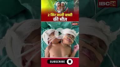 2 सिर वाली बच्ची की मौT #mpnews #indore #viralvideo #viralnews #judwaa #twins