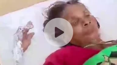 घाटमपुर: बारीगांव में हाईटेंशन करंट की चपेट में आने से बुजुर्ग महिला बुरी तरह झुलसी