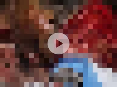 नौगावां सादात: नौगांवा अमरोहा रोड पर बाइक फिसलने से दंपती घायल, अस्पताल में भर्ती