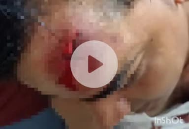 एत्मादपुर: श्याम विहार में एक युवक ने राशन डीलर पर मारपीट का आरोप लगाया, सिर में आई गंभीर चोट, मुकदमा दर्ज