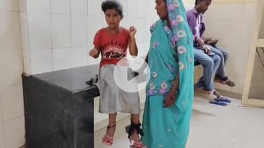 पडरौना: बलकुड़िया में पागल कुत्ते का आतंक, मासूम बच्ची गंभीर, गोरखपुर रेफर, ग्रामीणों ने पागल कुत्ते का किया अंत