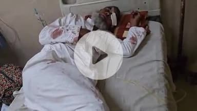 लाडपुरा: मंडाना टोल प्लाजा के निकट मोटरसाइकिल दुर्घटना में पिता-पुत्र घायल, एमबीएस अस्पताल में भर्ती, उपचार जारी