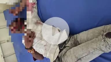 बाह: करकौली में आमने-सामने बाइक की भिड़ंत, दो युवक गंभीर घायल, आगरा किया गया रेफर